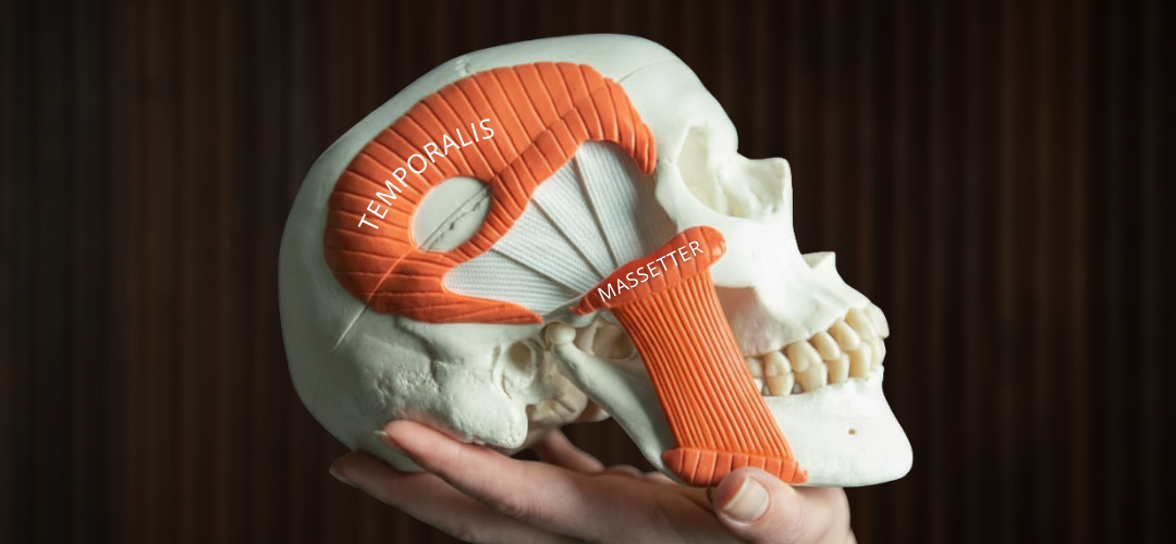 Purentalihashieronnasta apua moniin oireisiin